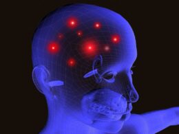 Akut Dissemine Ensefalomiyelit (ADEM) Nedir? - DoktorSensin